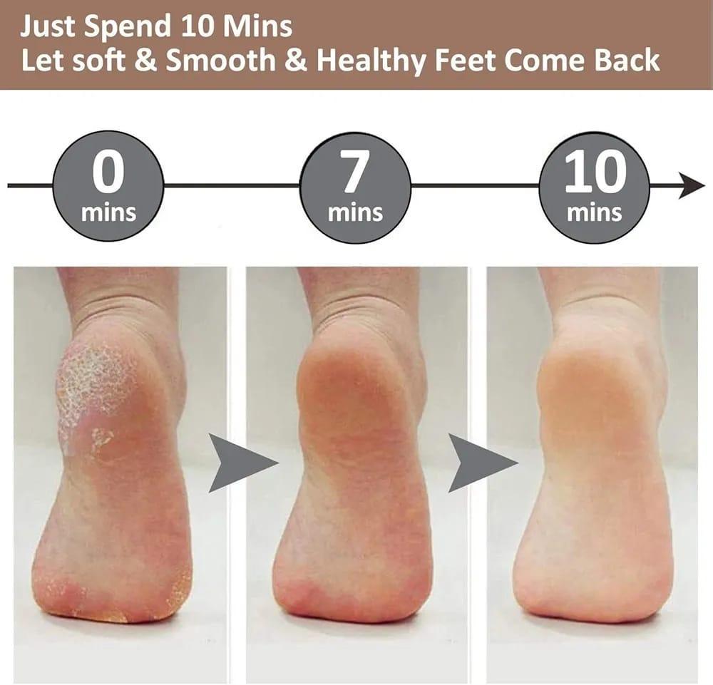 Electric Foot Exfoliator Pink USB Rechargeable ABS